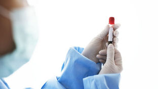 Hepatitis A breitet sich in Prag aus: Stadt verstärkt Aufklärung und Hygiene