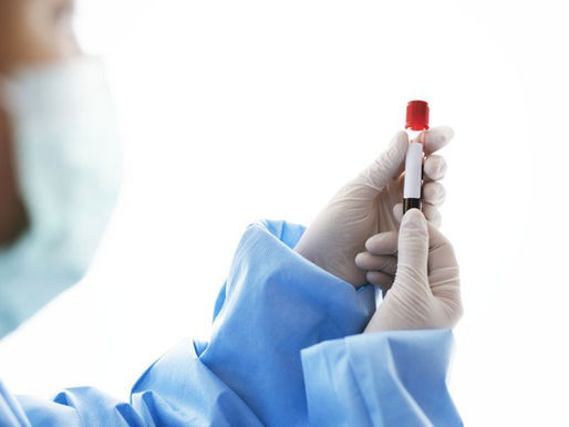 Wachsende Nachfrage nach Hepatitis-A-Impfung in Tschechien