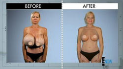 Said she felt like a walking BOOB?!