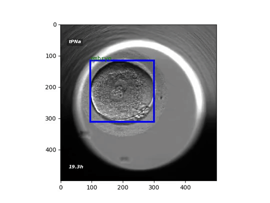 In vitro fertilization (IVF) preprint uploaded to medRxiv!
