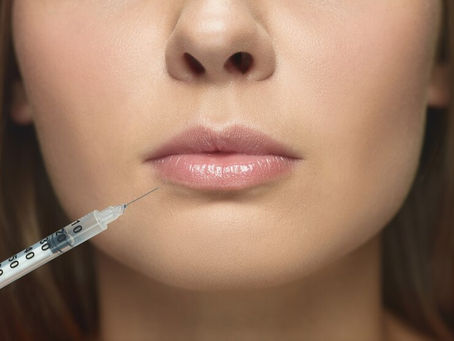 Double Lip Line Explained: Why It Happens and How to Treat It Effectively