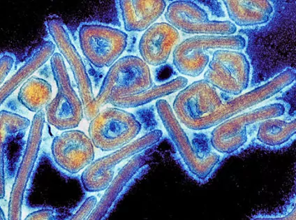 La OMS informa de dos casos de infección por el virus de Marbug en Ghana