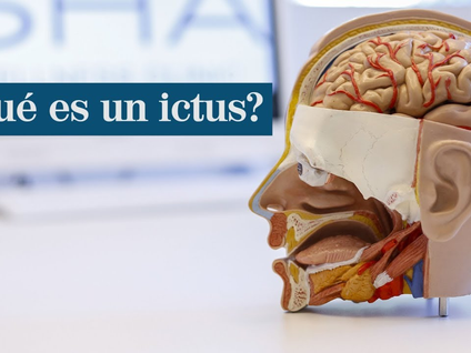 Qué es un ictus: síntomas, causas y qué secuelas deja a quien lo sufre