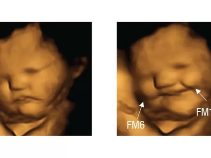 El estudio que mostró que los bebés en el vientre "sonríen" cuando sus mamás comen