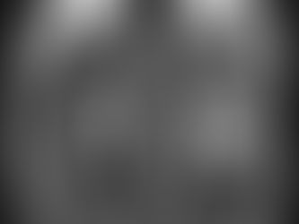 Un Tumor Cerebral Agresivo Podría ser Diagnosticado con un Simple Análisis de Sangre en el Futuro