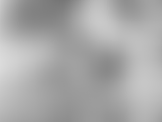 Viruela del mono: ¿Hay casos en Chile? ¿Hay vacuna? ¿Cómo se contagia? Todo lo que sabemos saber