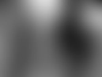 Artritis Reumatoide: la enfermedad inflamatoria crónica que afecta a las articulaciones