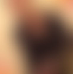 How is Acupuncture Used for Health in China