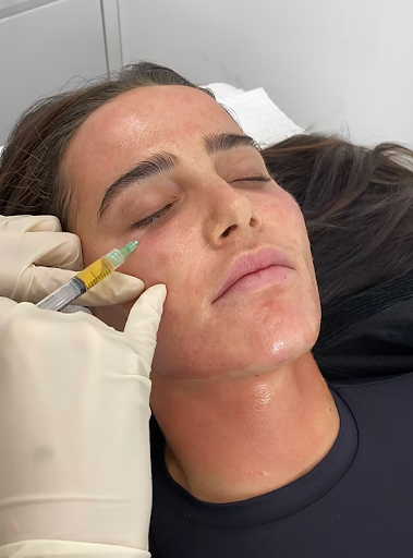 PRP Facials & Advanced Skin Tightening Fairfield Residents Love in 2025