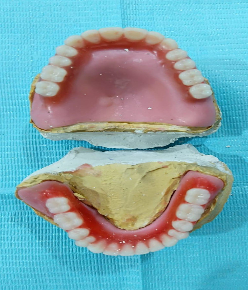 CompleteDenture_jpg1_edited