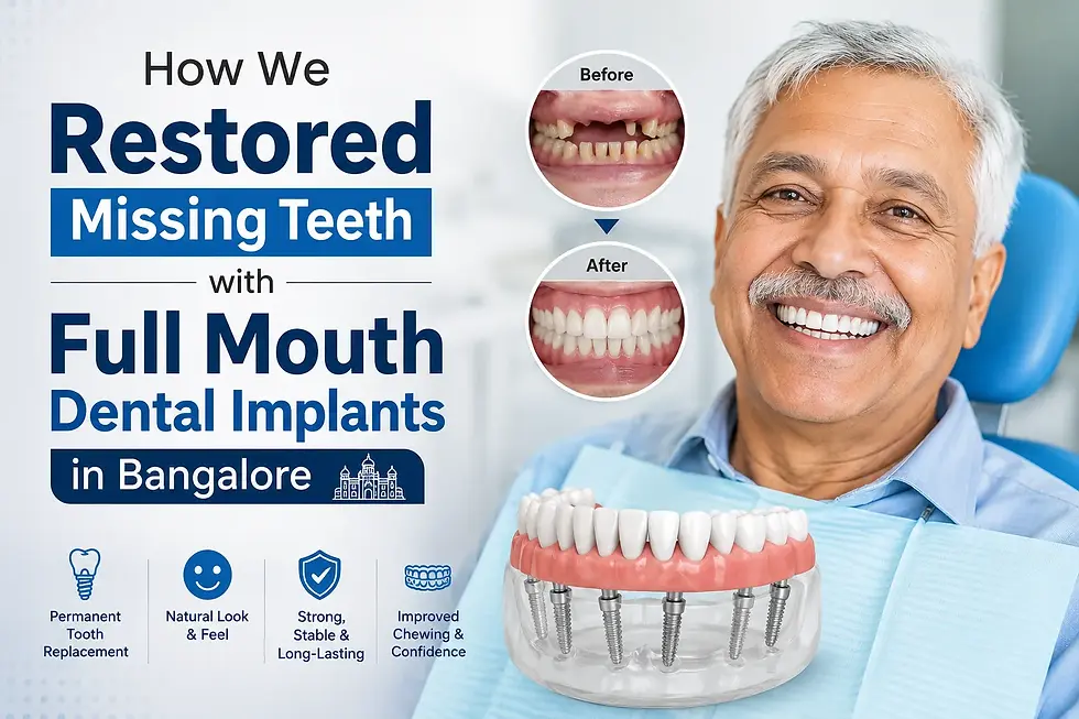How We Restored Missing Teeth with Full Mouth Dental Implants in Bangalore