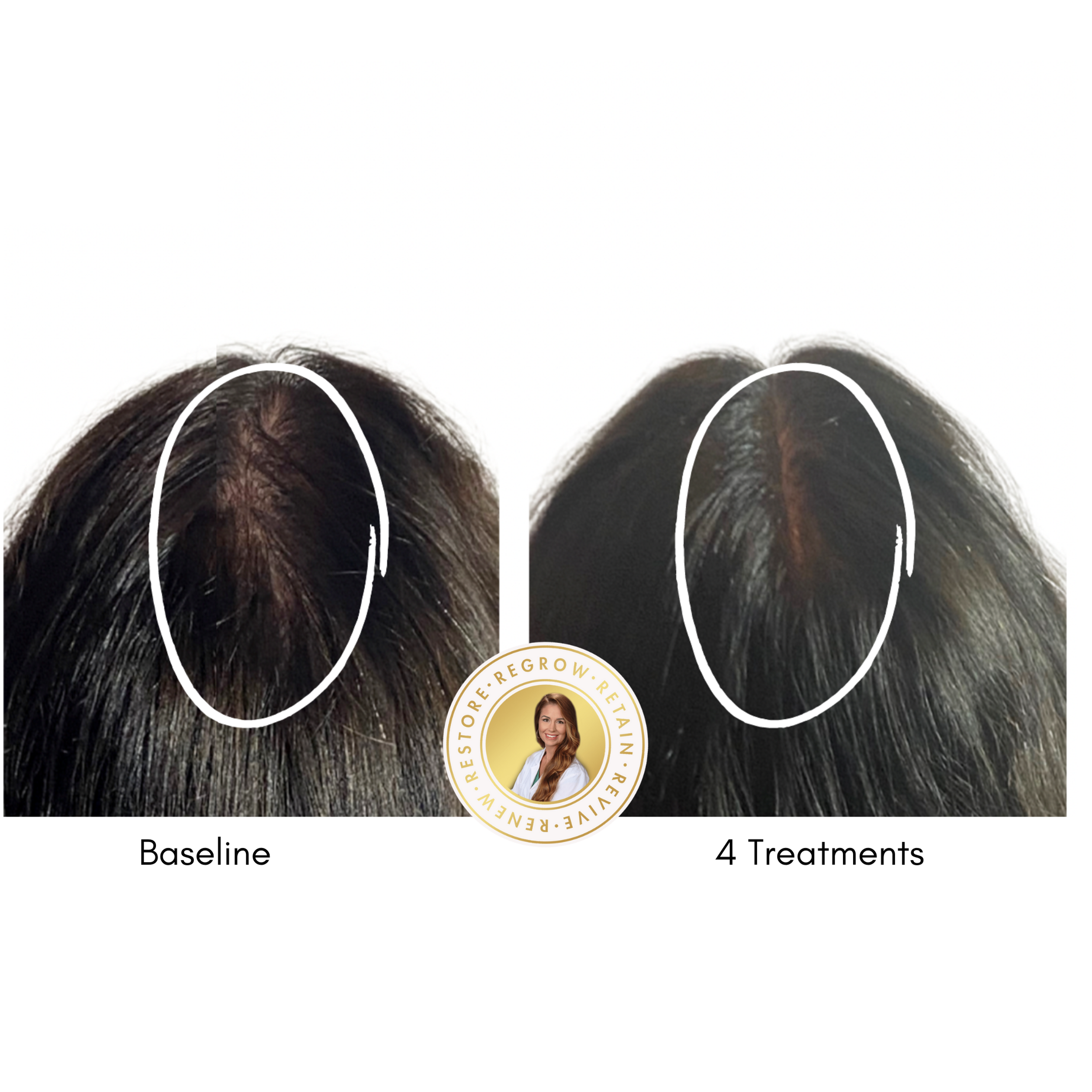 Advanced Hair Technologies /Trichologist/ Alma TED San Diego