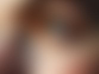 Mitől Öregszik a Tekintet – és Hogyan Lehet Látványosan Visszafordítani? Komplex Szemkörnyék Fiatalítással.