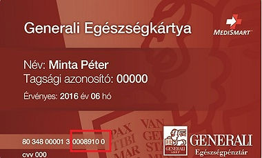 EEG. EMG és más neurológiai szolgáltatások is elérhetők Generali EP kártyával a Flash Clinic Neuro-nál.