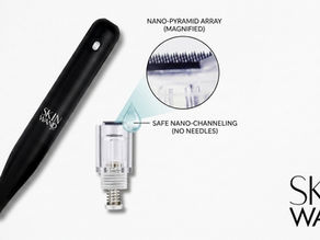 How to Reduce Acne Scars at Home Using Skin Wand Pro