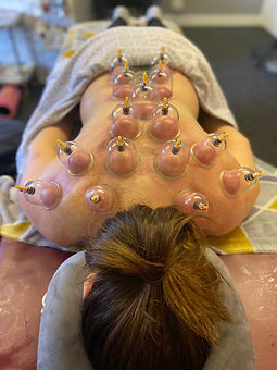 cupping back.jpeg