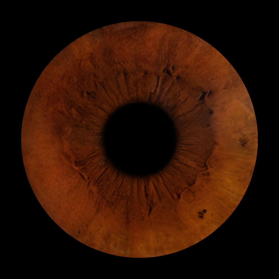 Irisfoto-5.jpg