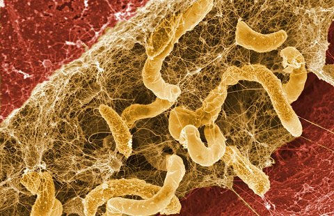 Desulfovibrio desulfuricans sulfur reducing bacteria biofilm