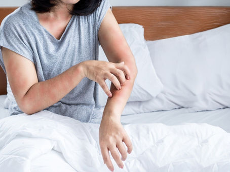 Benadryl (Diphenhydramine) IV Therapy: Fast Relief for Allergies and More