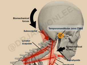 TMJ and forward head posture are linked through the upper cervical spine
