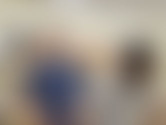 猫背矯正のセルフケアについて!