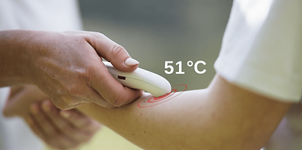 iea-medical-insektenstichheiler-temperatur.png.png