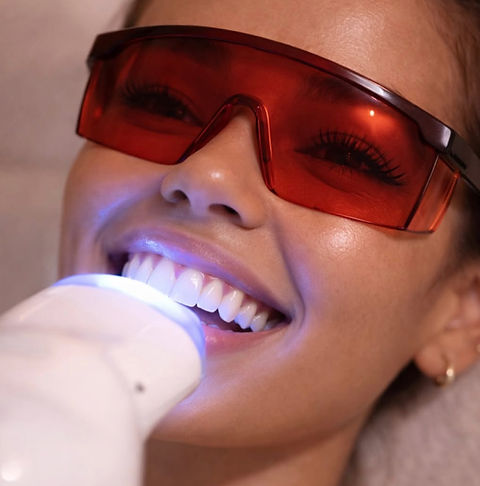 Studio Twelve Cosmetic NaturaWhite Teeth Whitening Treatment Mildenhall Suffolk Thetford L