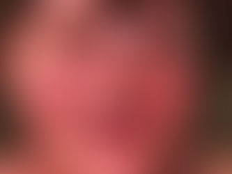 FROM MARK OWENS-SEE THIS RASH FROM COVID 19 VACCINE