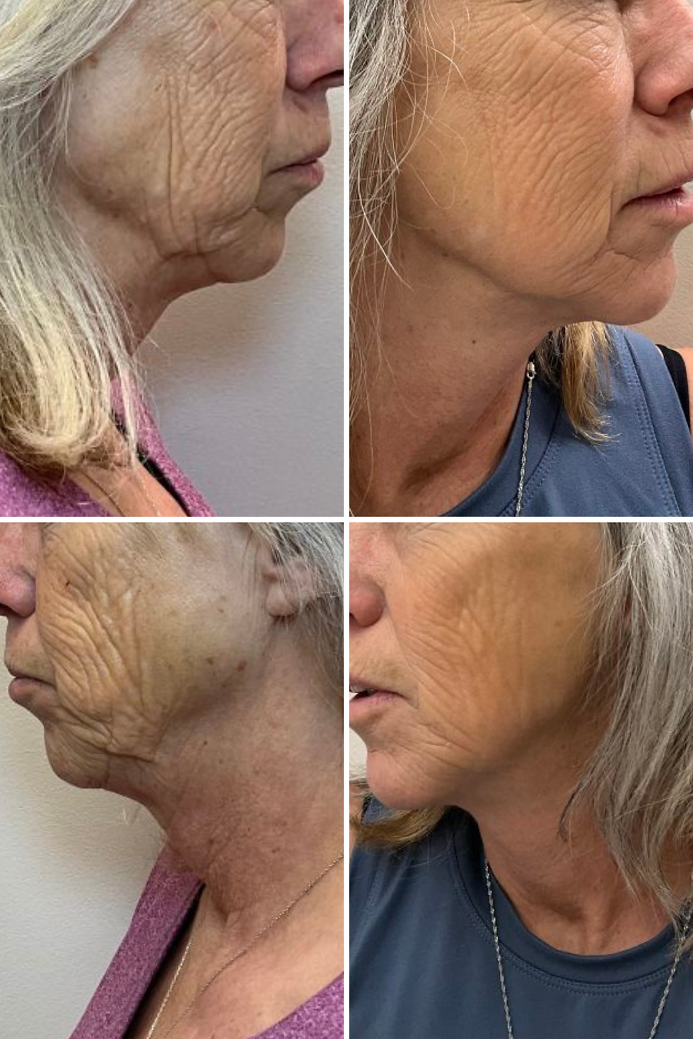 Beautiful Aesthetics AZ, Beautiful Aesthetics Med Spa, Beautiful Aesthetics Tempe, Med Spa near me, Aesthetics near me, med s