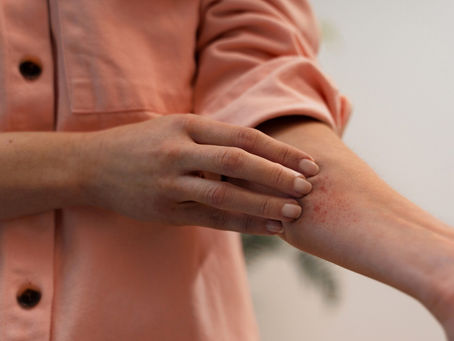 Aquagenic Urticaria