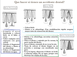 Consejo Dental de La Semana 2