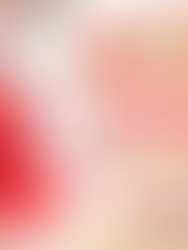 1月限定オプション