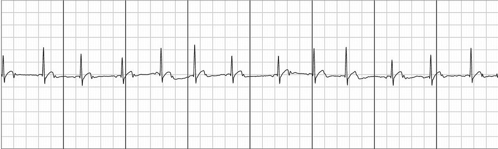 ecg.jpg
