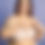 Thumbnail: Inserting Bra Filler for Asymmetry