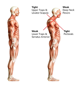 Tightpectoralishoulders.png