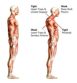 Tightpectoralishoulders.png
