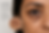 image of a deeper fitzpatrick skin tone women showing pigmented dark circles