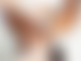 Person smiling while receiving a facial treatment with a device. Hands in gloves perform the procedure. They wear a robe with "dermalogica" text.