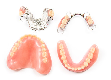 removable partial denture on white backg