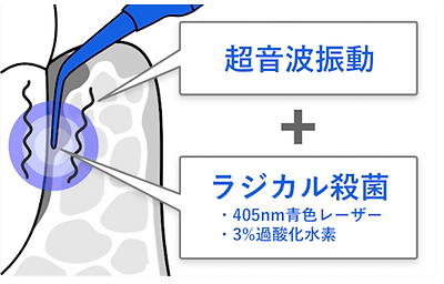 ブルーラジカル