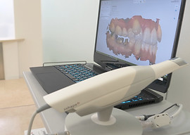 Merit500 口腔内スキャナー　先 口腔内スキャナー｜審美,矯正,予防治療のみうら歯科医院