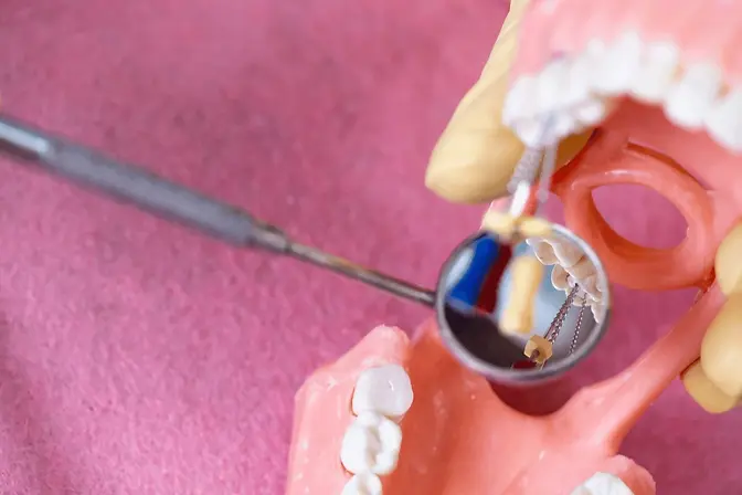 Reliable Root Canal Treatment.webp