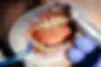 Preventive Dentistry (1).webp