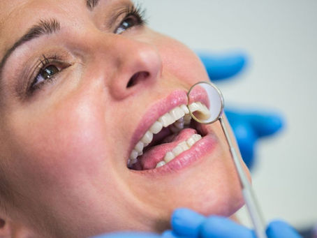 How Long Do Dental Implants Last?