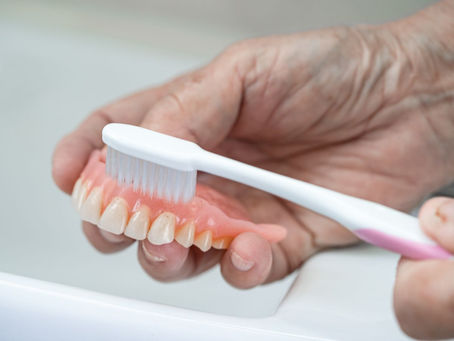 What Happens During Denture Fitting?