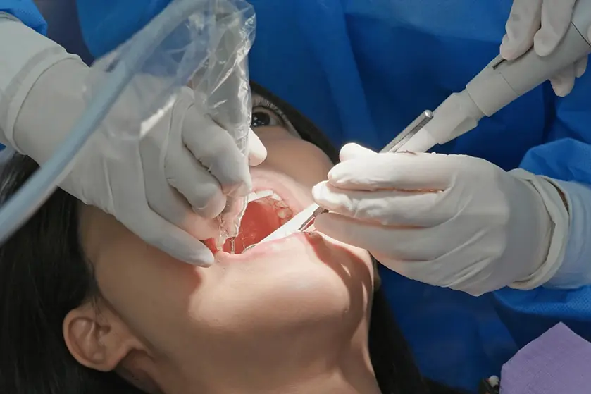 What Are Pulpotomy & Pulpectomy.webp