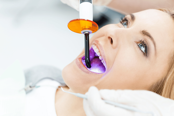 Dental Sealants Sydney.png