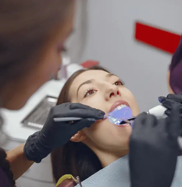 Expert Dental Bonding.webp