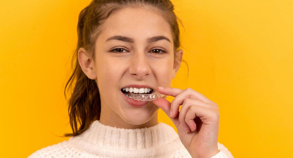 Clear Aligner