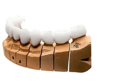 iDD Dental Lab (14).webp